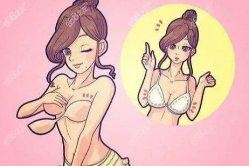 杭州假體豐胸醫(yī)院排名！美萊雙平面植入、藝星媽生胸技術(shù)出名,附術(shù)例價格