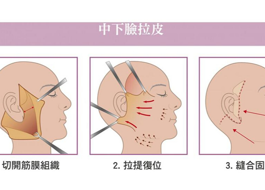 趙延勇和畢洪森醫(yī)生的背景與坐診信息
