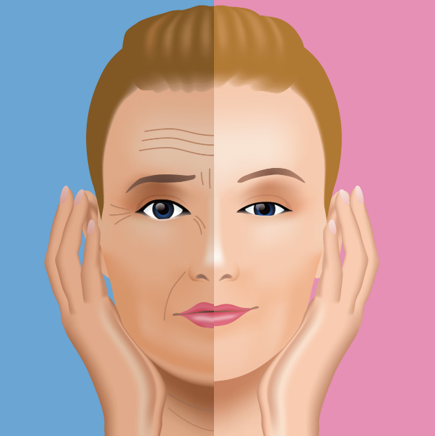 除皺手術(shù)就診全攻略