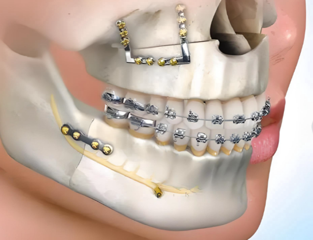 何錦泉正頜手術(shù)在深圳哪里任職