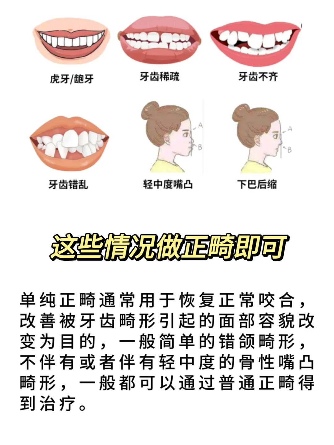 影響牙齒矯正價格的因素