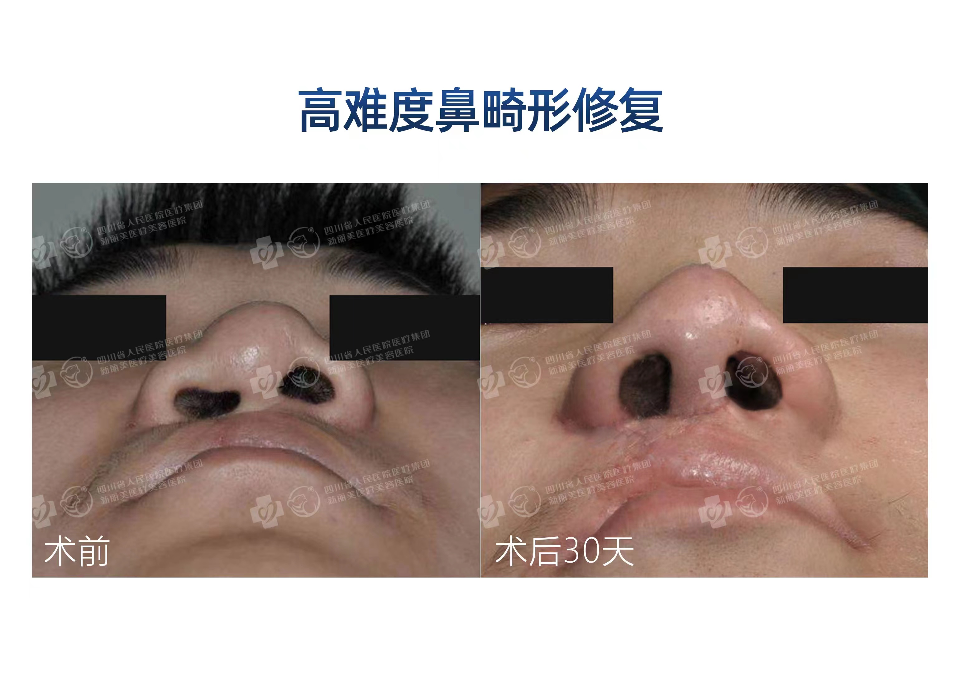 五、患者評(píng)價(jià)與反饋