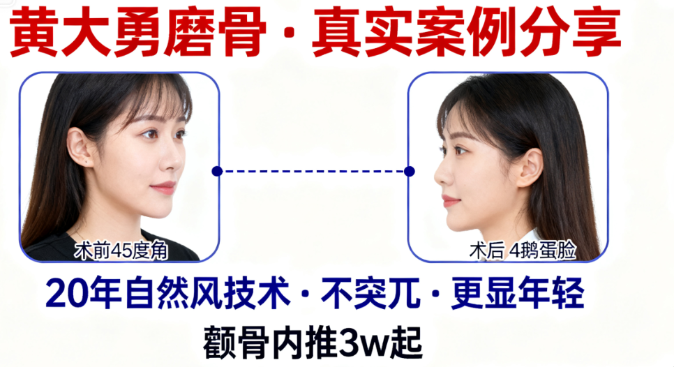 北京圣嘉榮黃大勇磨骨手術價格明細