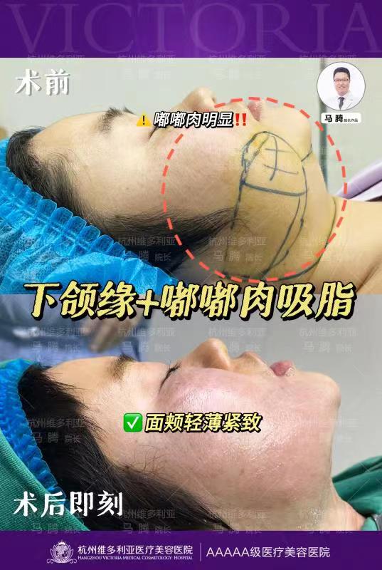 羅明生醫(yī)生的不錯(cuò)技術(shù)體現(xiàn)在哪些方面？