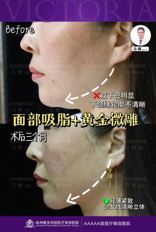 貼心服務(wù)是如何讓顧客收獲滿意成效的？