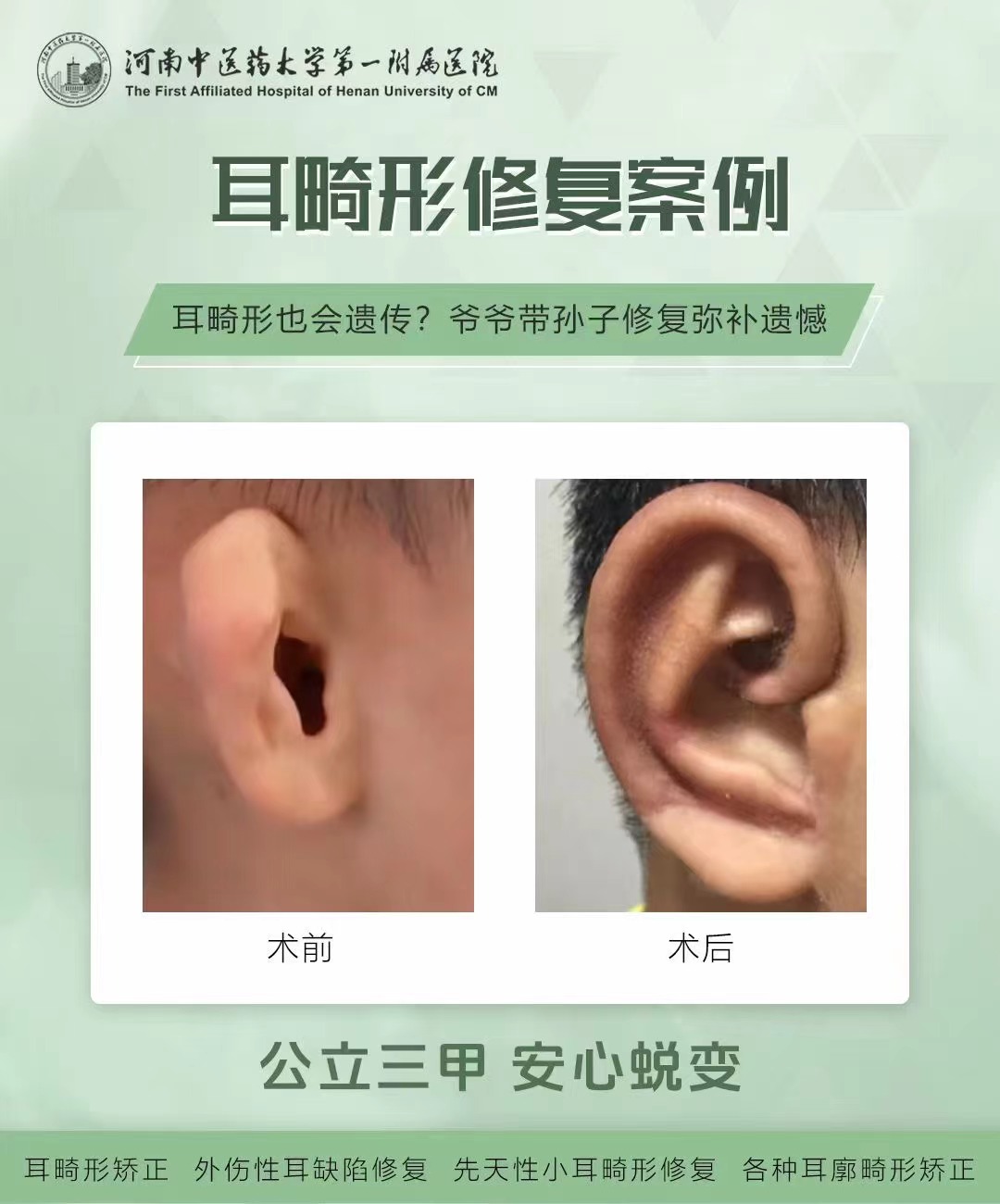 羅明生醫(yī)生吸脂成效究竟怎樣，能實現(xiàn)理想蛻變嗎？