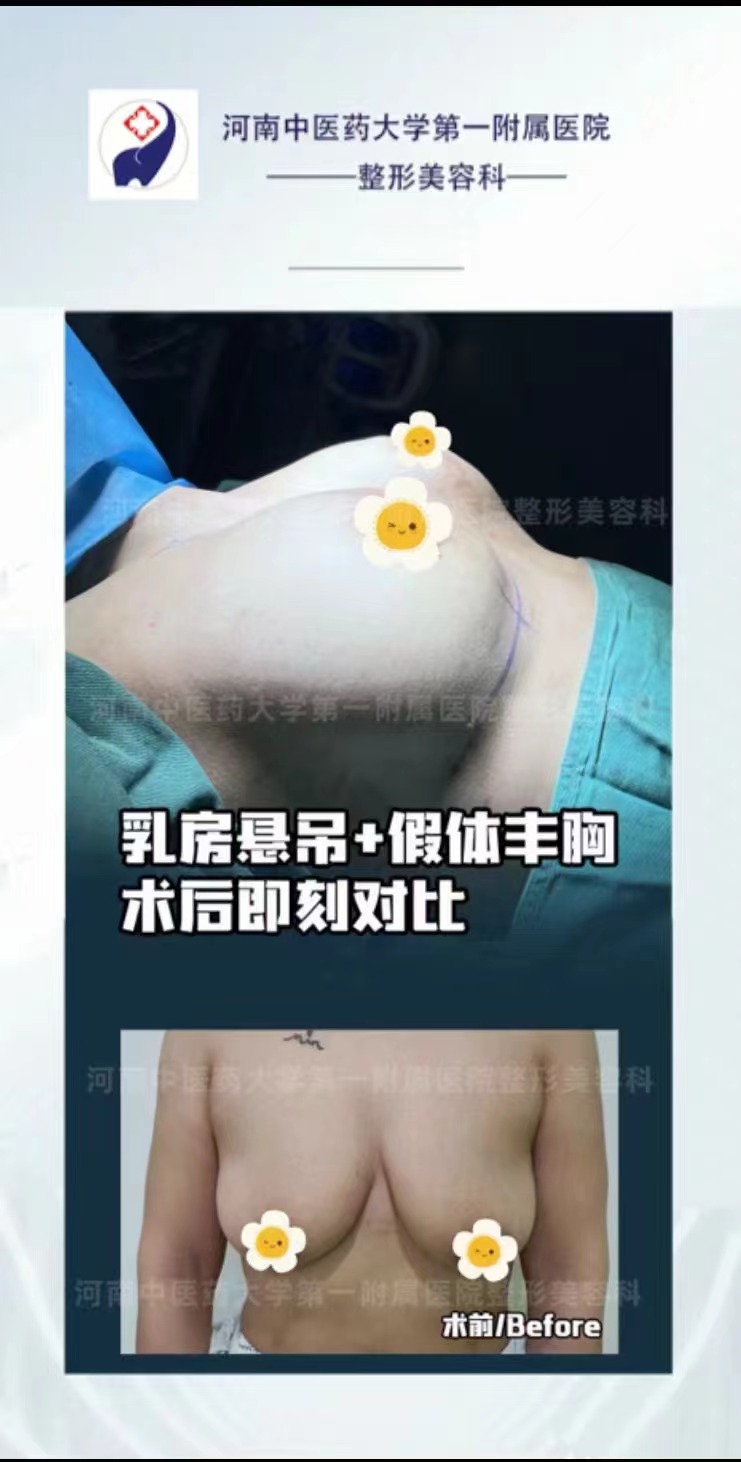 羅明生醫(yī)生在鄭州吸脂醫(yī)生中排名如何，技術(shù)水平值得信賴嗎？