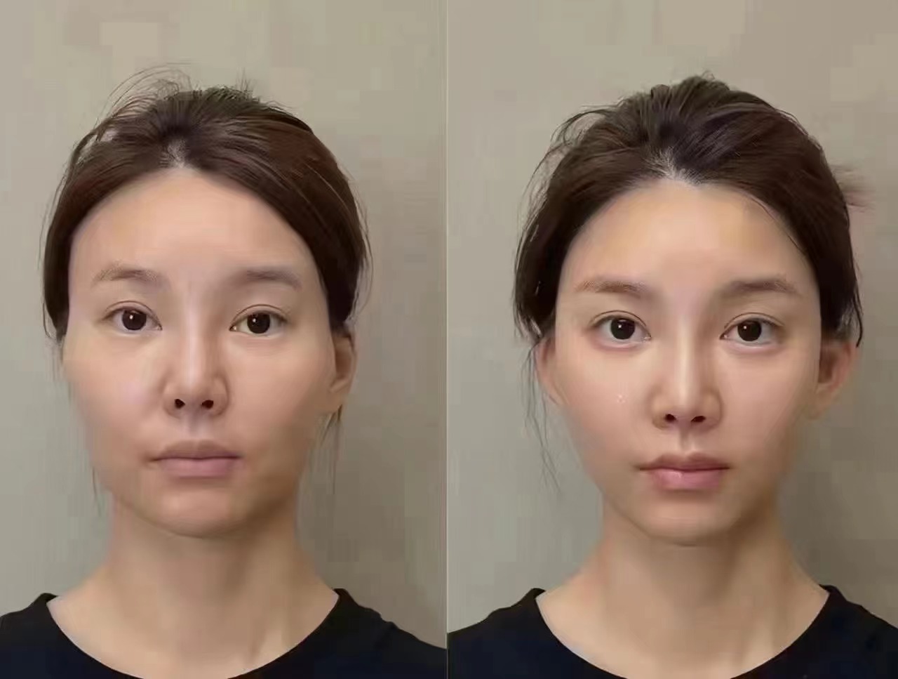 羅明生醫(yī)生實力幾何，為何能在吸脂領(lǐng)域脫穎而出？