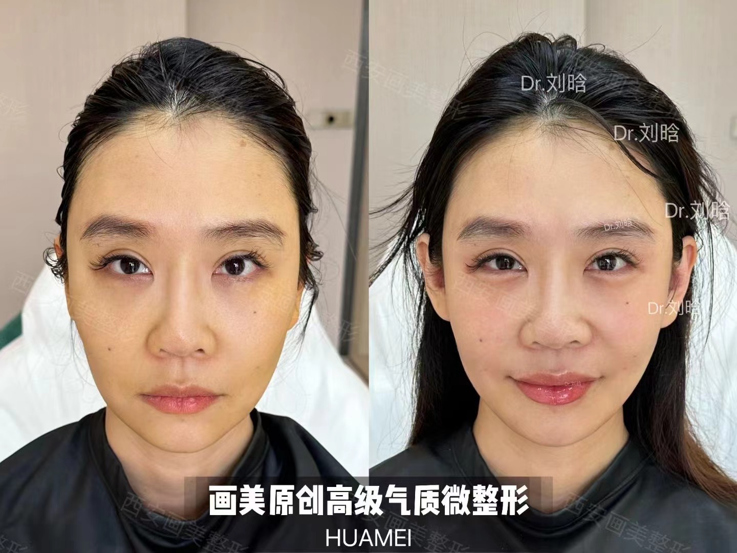 鄭州麗天整形醫(yī)院靠譜嗎，資質(zhì)和口碑有保護(hù)嗎？