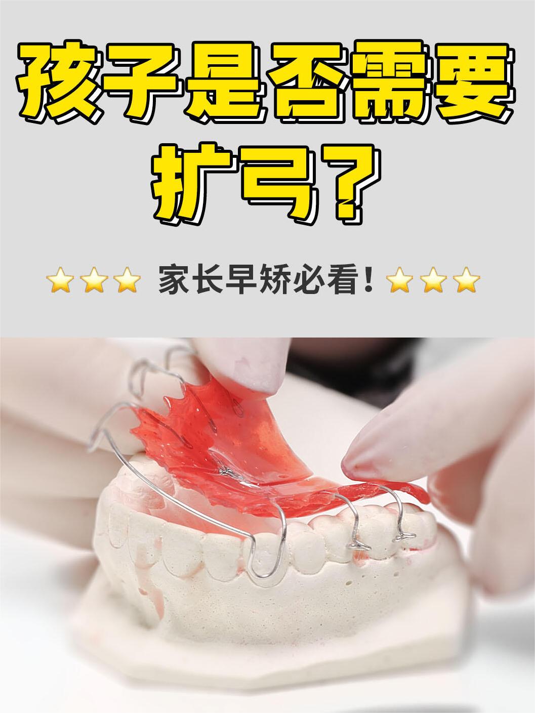 濰坊市南關(guān)牙科價(jià)目表流出——正畸價(jià)格全知道