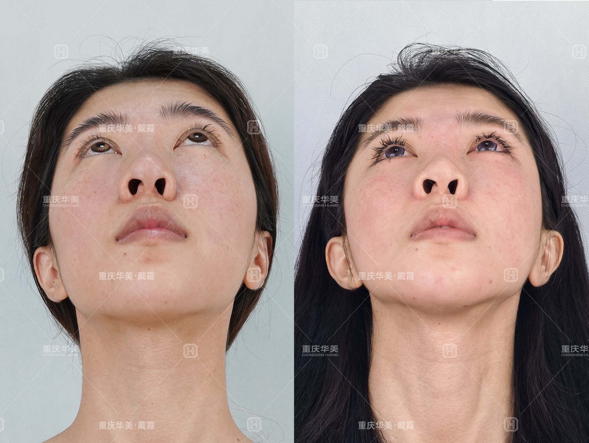 包头市整形机构排名榜前五的实力医院——包头市嘉美医疗美容