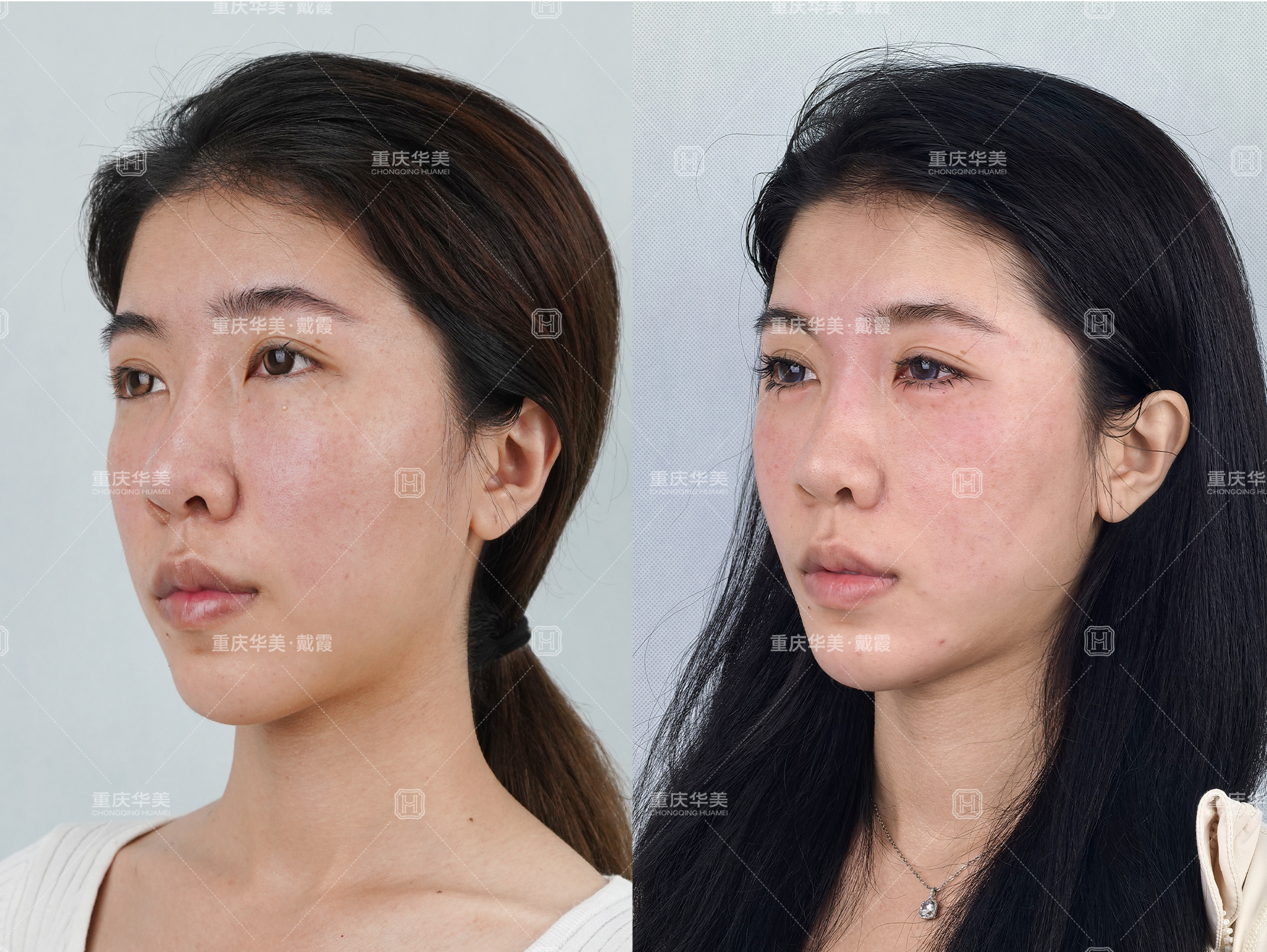 包头市整形机构排名榜前五的实力医院——内蒙古伽蓝医疗美容