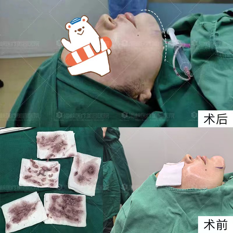 选对医院，告别奥美定烦恼