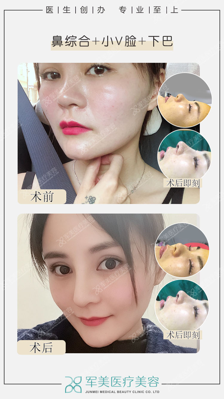 广州军区总医院：保密安心的清奥之选