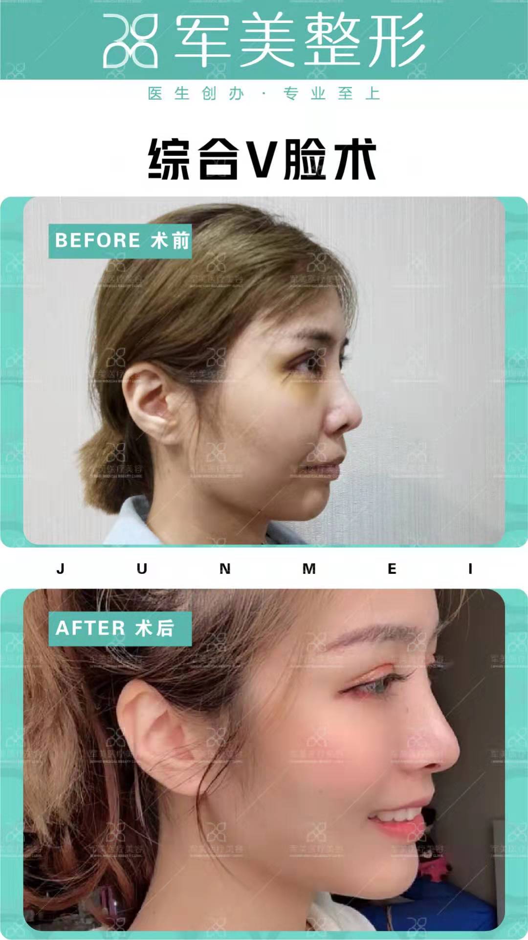 佛山市禅城区人民医院（广州分院）：性价比高的清奥之选