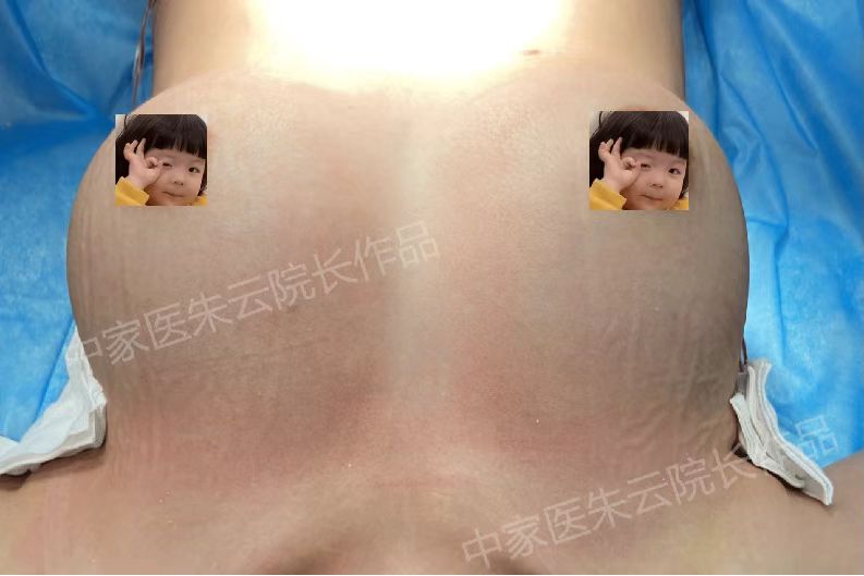 南方医 科 大学珠江医院：数字化清奥先锋