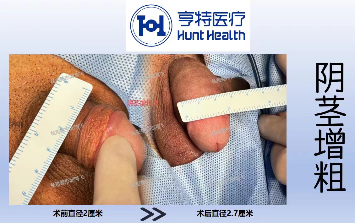 關(guān)于醫(yī)生的技術(shù)選擇建議