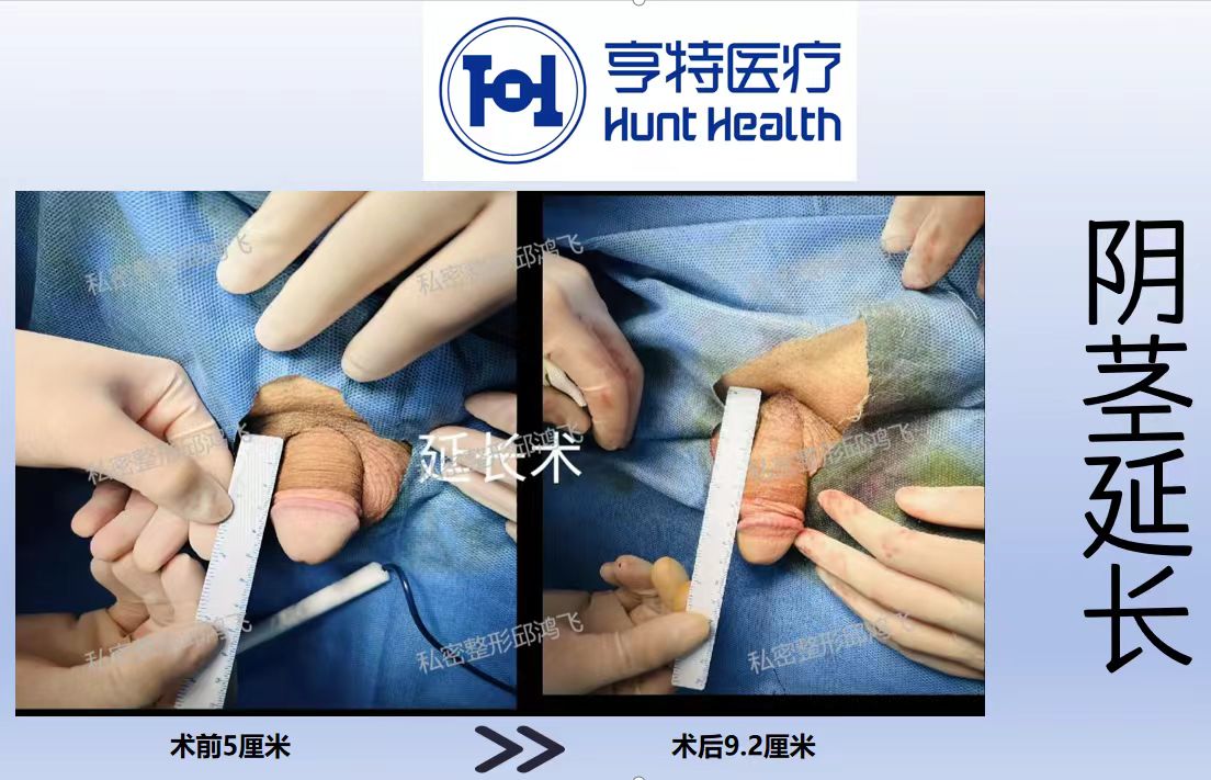 掛普通號和掛?？铺柕膮^(qū)別在哪？