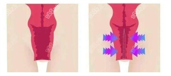 多地婦科醫(yī)院24小時免費(fèi)熱線大揭秘 多地婦科醫(yī)院24小時免費(fèi)熱線大揭秘