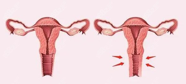 多地婦科醫(yī)院24小時免費(fèi)熱線大揭秘 多地婦科醫(yī)院24小時免費(fèi)熱線大揭秘