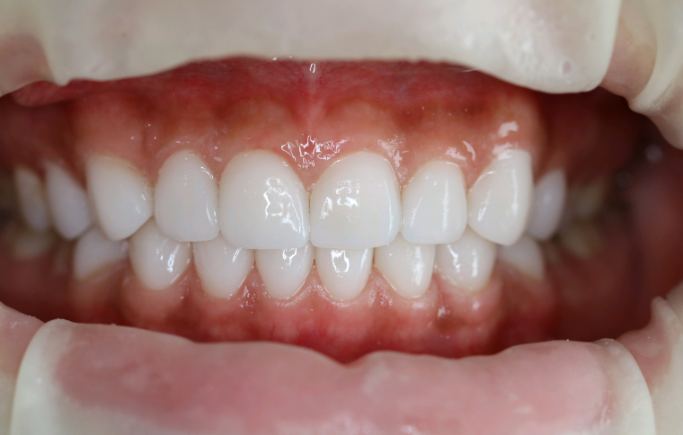 香港到深圳看牙哪個口岸比較方便