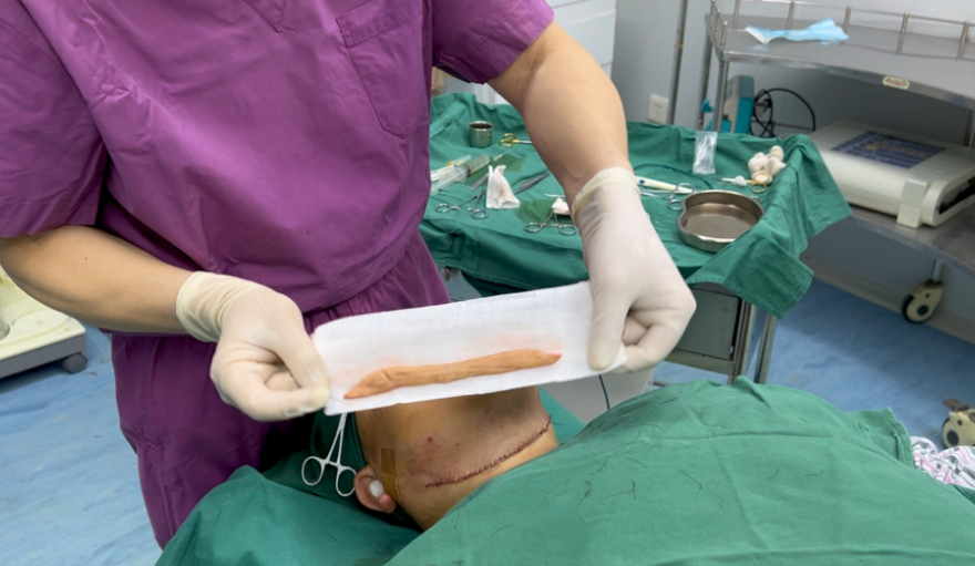 雙下巴抽脂醫(yī)院價(jià)格匯總