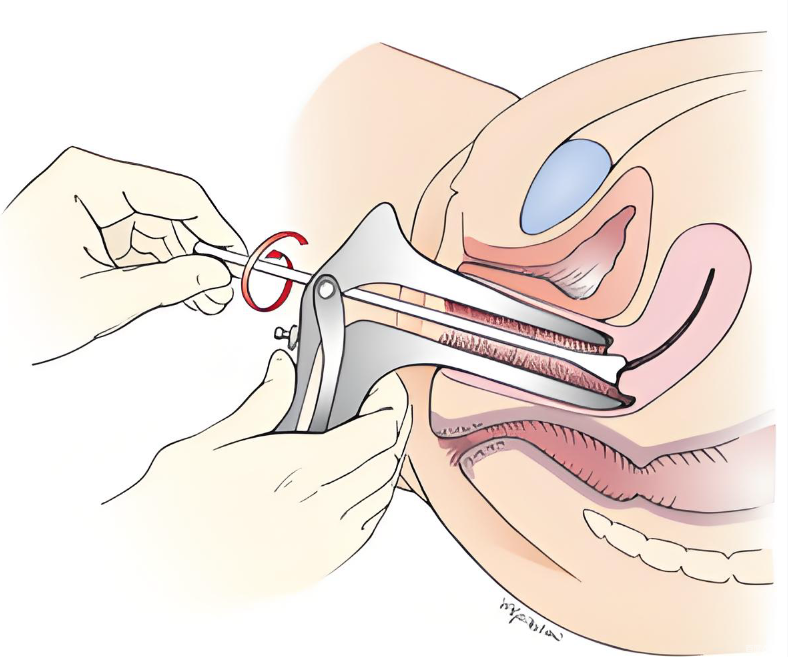 國(guó)內(nèi)哪個(gè)醫(yī)院私密整形做得好