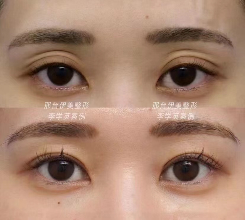 南方醫(yī)院脂肪填充的價格體系