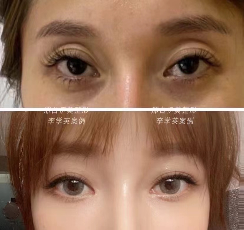 馮傳波醫(yī)生：精細(xì)操作的典范