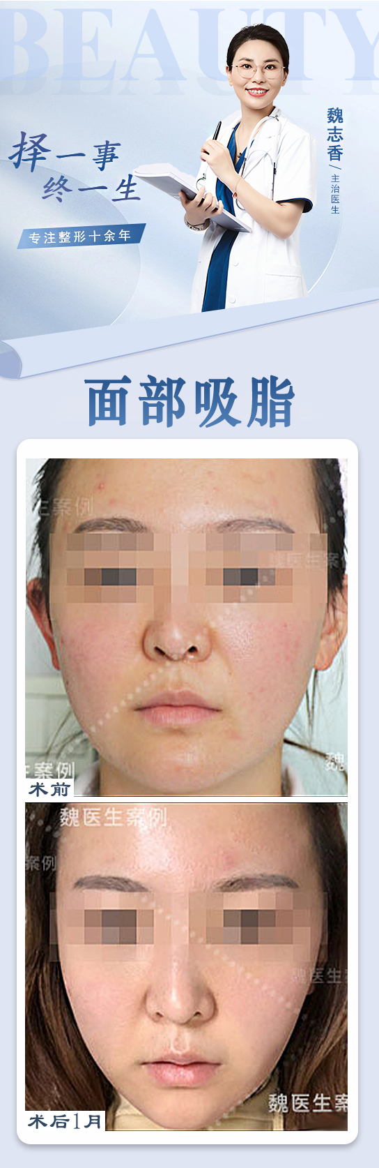 成都軍大整形外科醫(yī)院怎么樣——醫(yī)療團隊實力雄厚