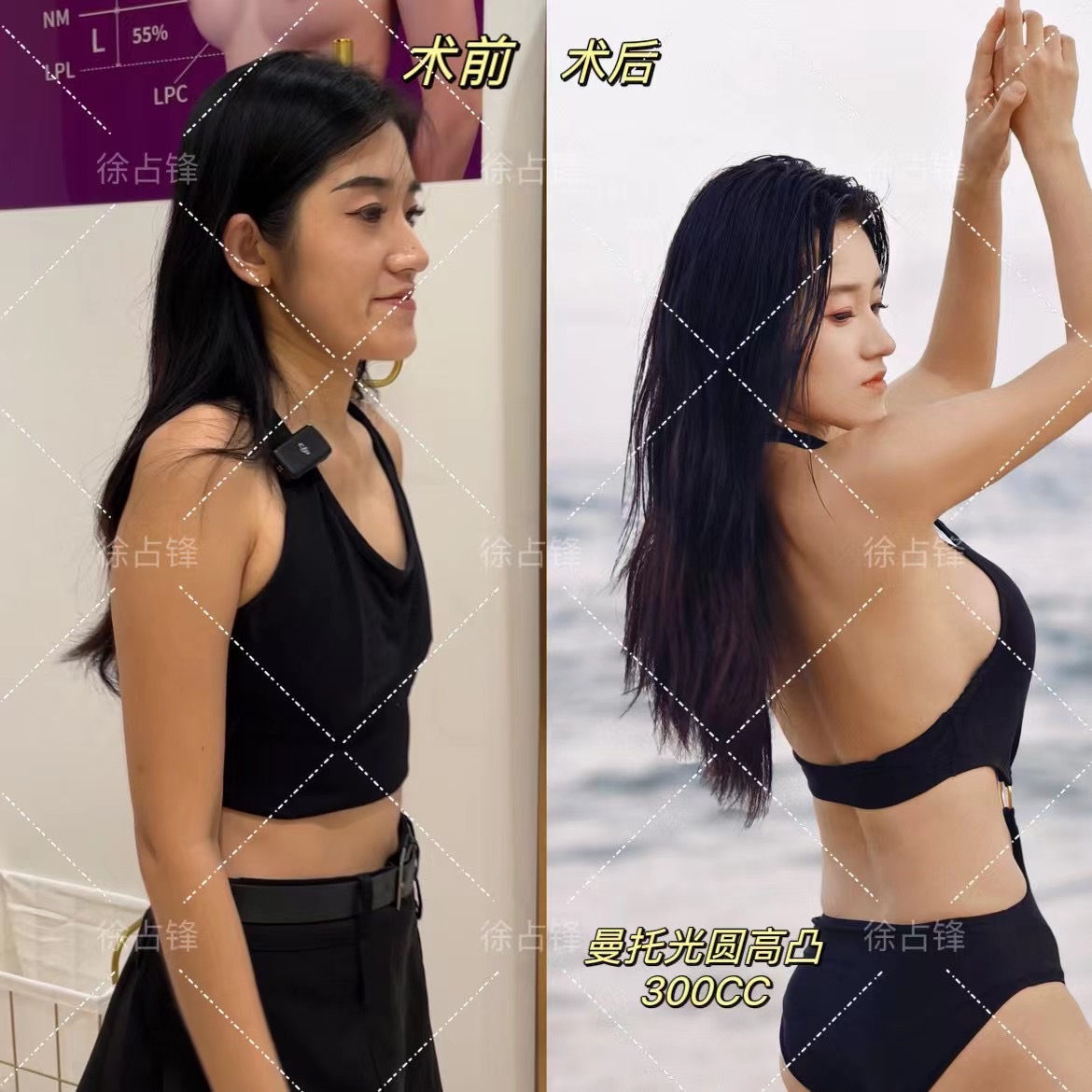 珠海新顏醫(yī)療美容門診部:專注眼胸整形的骨干醫(yī)生之選