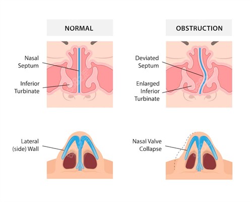 20251203519866.jpg 修復(fù)扭曲鼻子.jpg