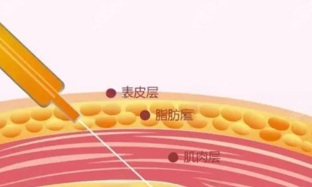 其他常見打造幼態(tài)臉?lè)绞? width=