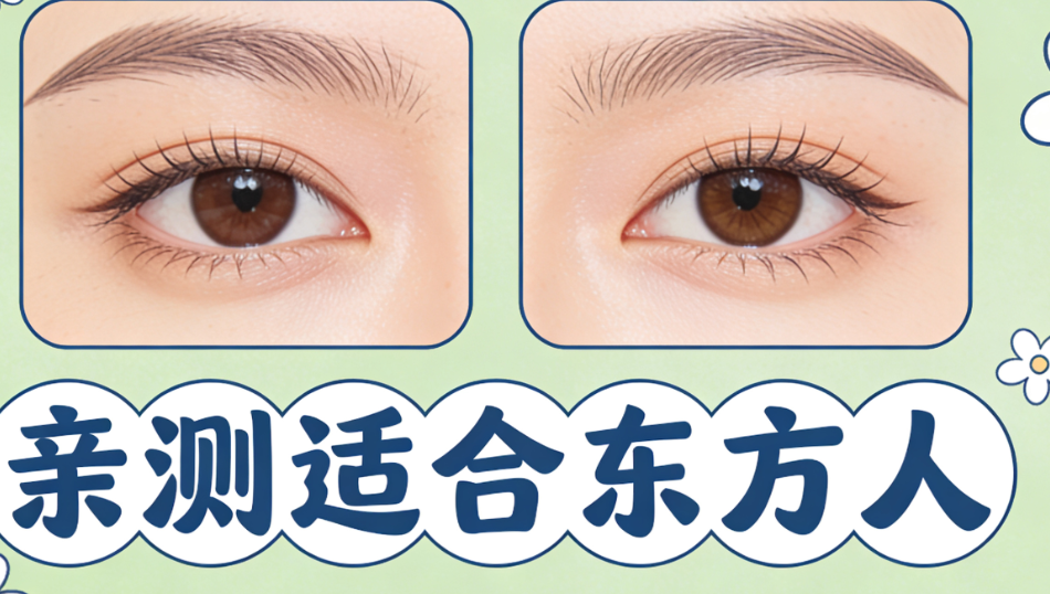 張大艷獨(dú)研的自然無(wú)痕雙眼皮技術(shù)解析