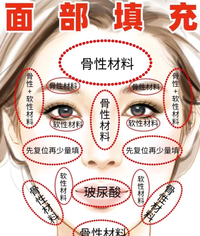 一、倪峰醫(yī)生脂肪填充技術(shù)到底怎么樣？www.sorencai.cn