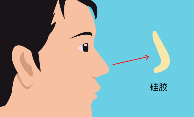 北京巫文云鼻整形實例的核心特點與用戶反饋