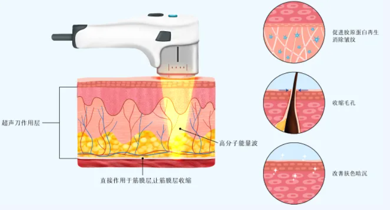 三、南京艺星的超声炮是真的吗？仪器验真很重要
