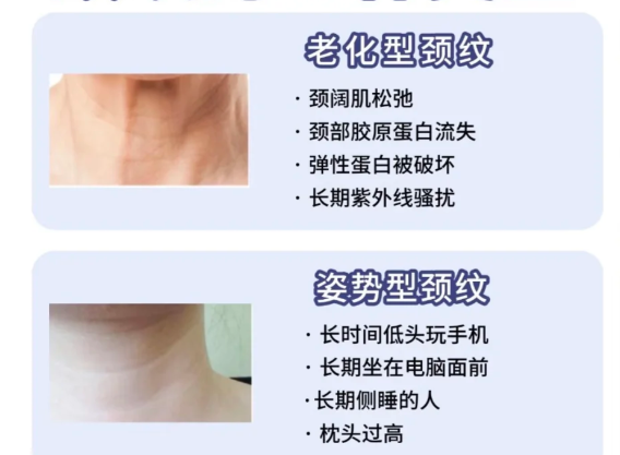 魏廣運頸闊肌拉皮去頸紋:價格構(gòu)成與影響因素