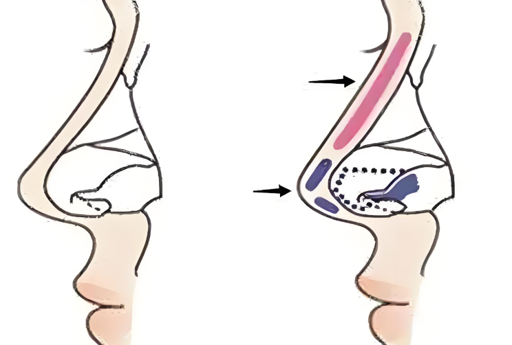 徐士亮醫(yī)生審美風格