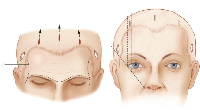 真實(shí)實(shí)例