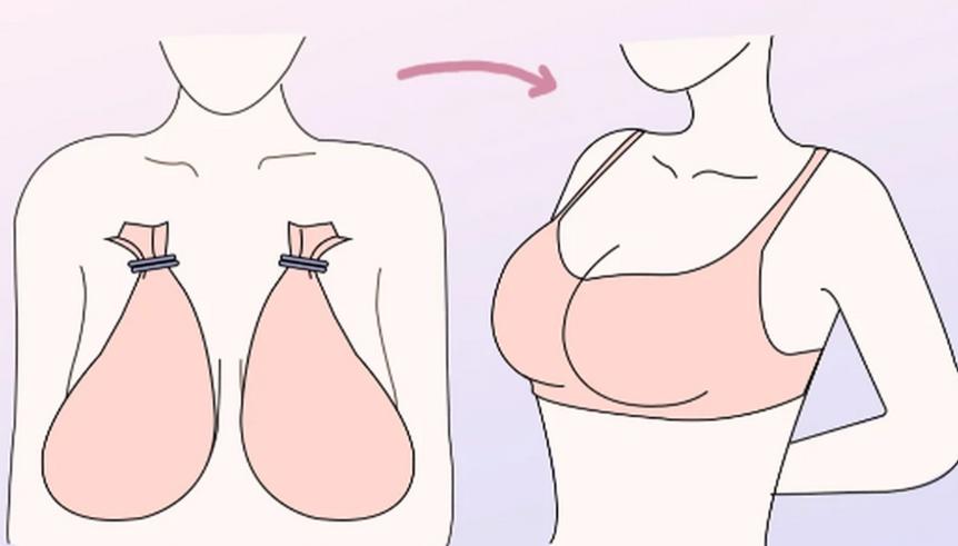 重慶曹勇縮胸手術