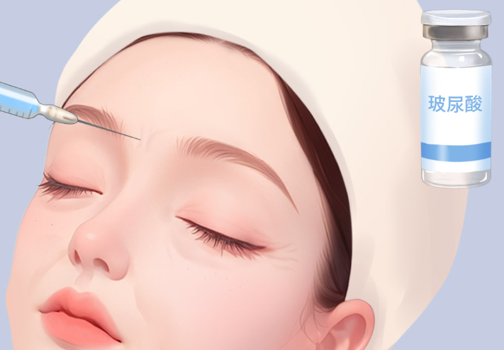 曼微羽玻尿酸和伊婉玻尿酸哪個好？維持時間大PK