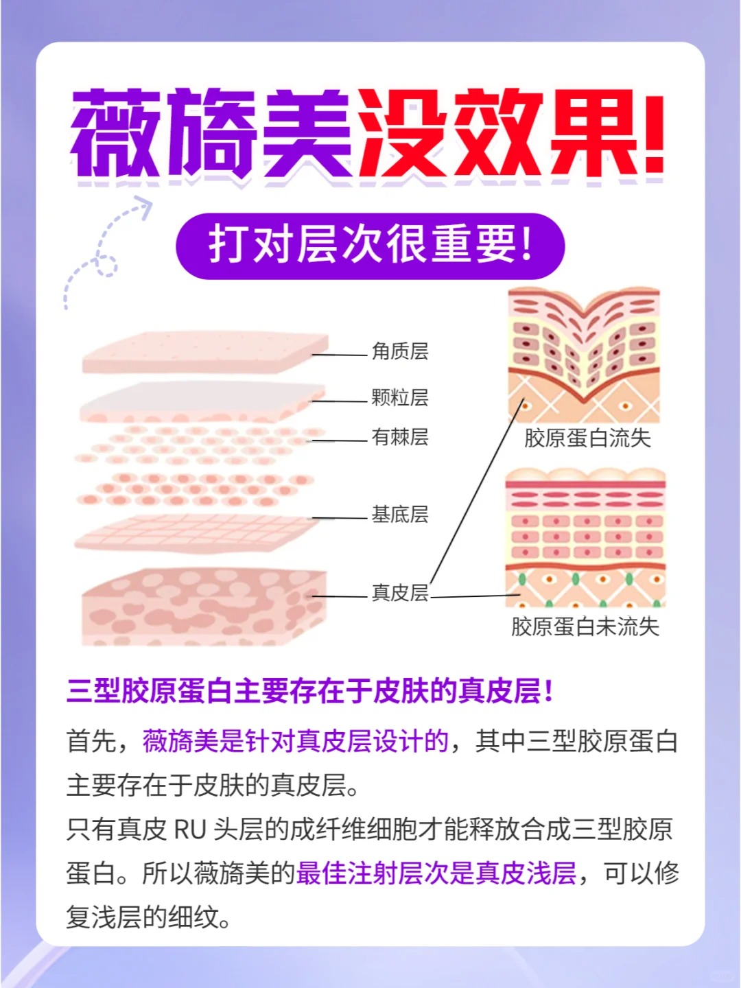 选择胶原蛋白注射医院的注意事项