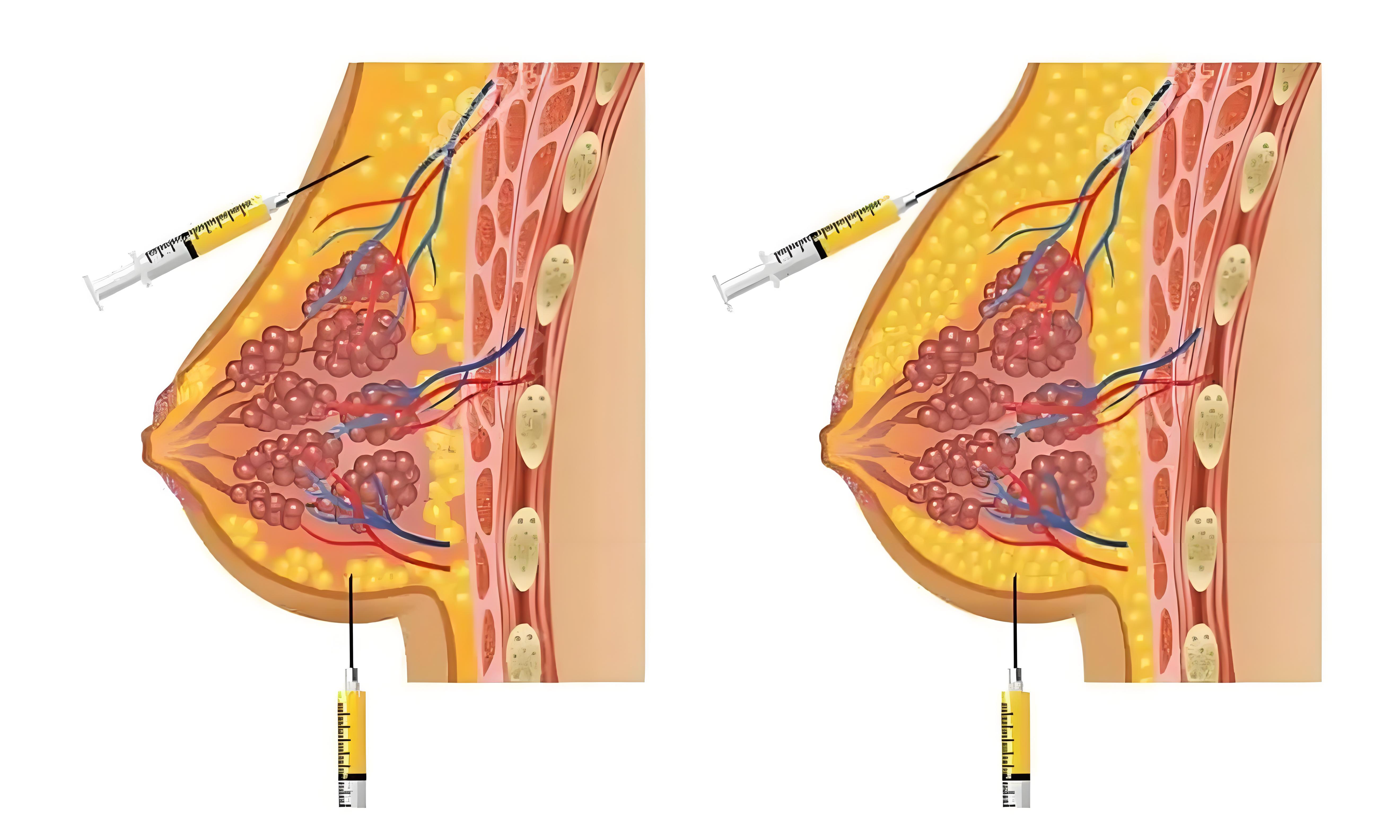  北京趙潤蕾掛號避坑 & 進(jìn)階技巧：不花冤枉錢，提高成功率概率