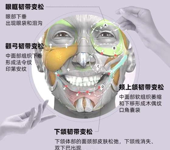 七、拉皮手術(shù)前必知的注意事項www.sorencai.cn