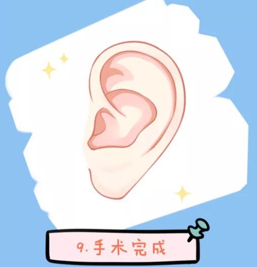 王悅醫(yī)生做耳再造手術怎么樣