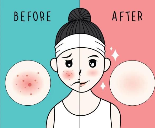 四、釜山MULY整形外科預約同到院攻略（附真實地址電話）