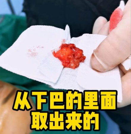 北京張立彬修復(fù)生長(zhǎng)因子靠譜嗎