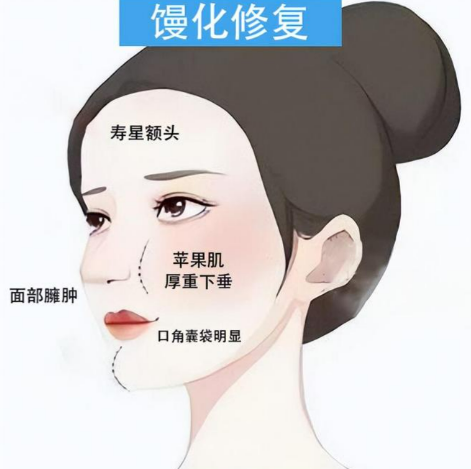 張立彬異物饅化修復(fù)價(jià)格表