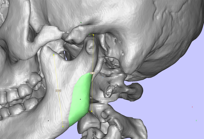 項(xiàng)昌峰磨骨醫(yī)院電話